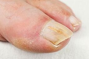 Lurra -finger
