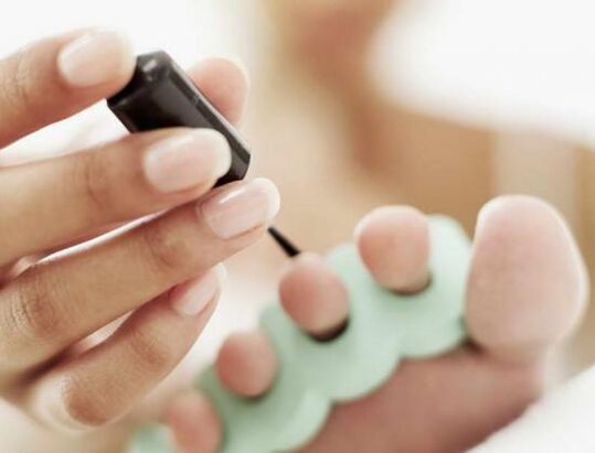 azazkalak onddoen infekzio baterako iltze esmaltearekin tratatzea