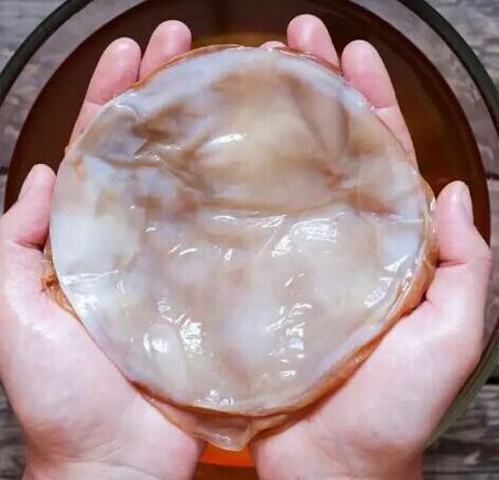 iltze onddo kombucha